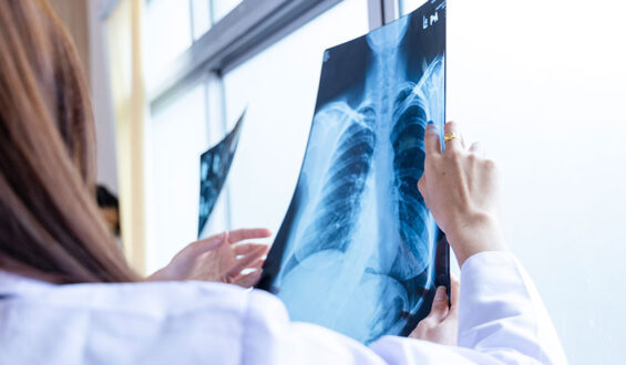AGFA HealthCare e Konimagem apresentam inovações na Gestão de Imagens Radiológicas na JPR 2024
